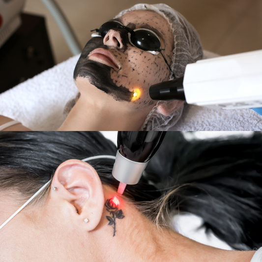 Formation : Détatouage et Carbon peel au laser
