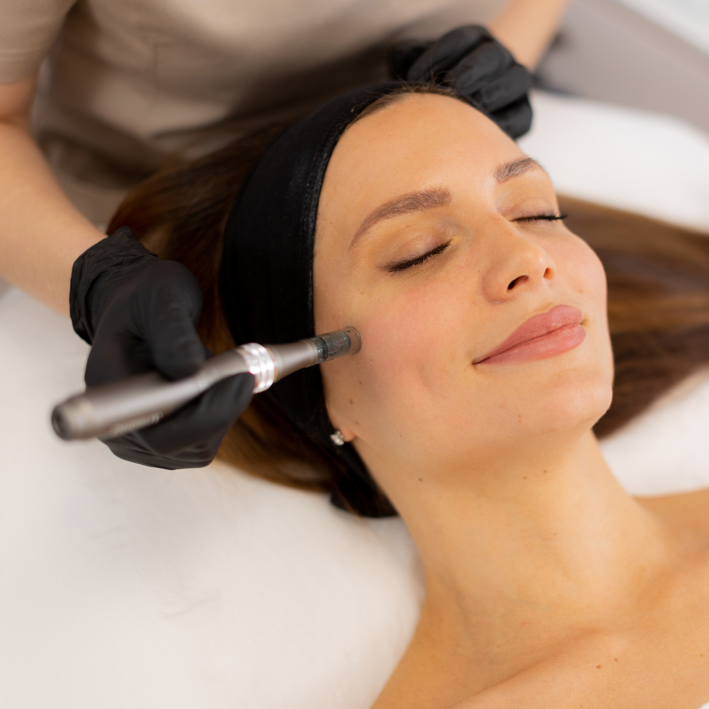 Formation combinée : Peeling et microneedling