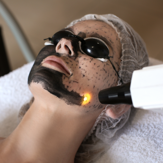 Peeling au charbon